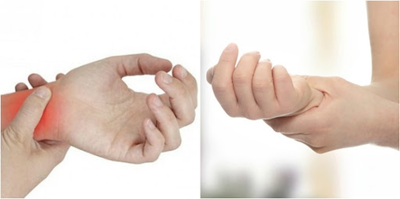 Bệnh lý thần kinh ngoại biên do hóa trị1