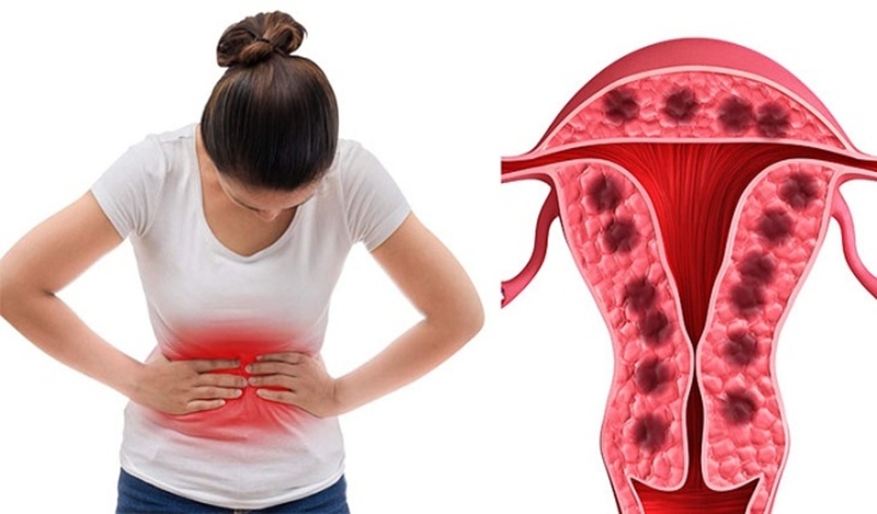 Bệnh lý tử cung là gì? Những điều cần biết trước khi mang thai 1