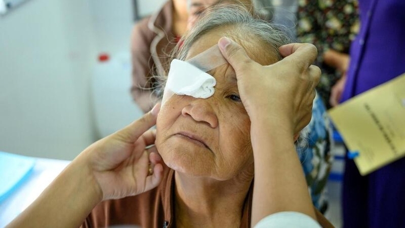 Bệnh màng tăng sinh trước võng mạc: Nguyên nhân, triệu chứng và cách điều trị 2