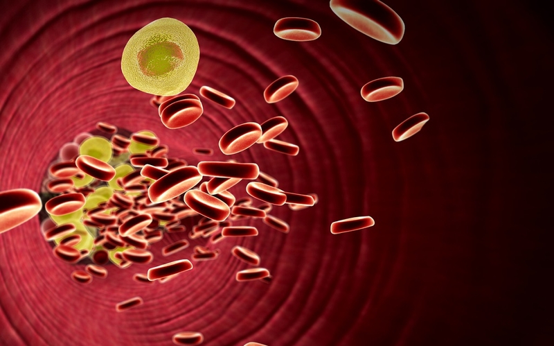 Bệnh máu nhiễm mỡ có nguy hiểm không? Cách phòng tránh bệnh thế nào? 3