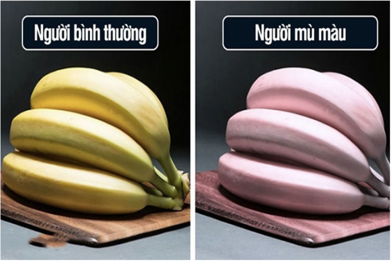 benh-mu-mau-do-va-xanh-luc-o-nguoi 1