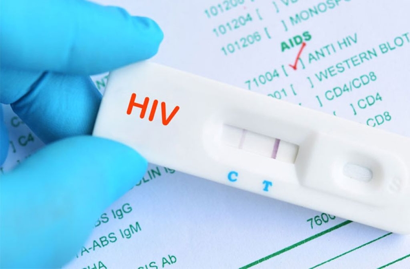 Bệnh nấm HIV: Nguyên nhân, triệu chứng và cách phòng ngừa hiệu quả 3