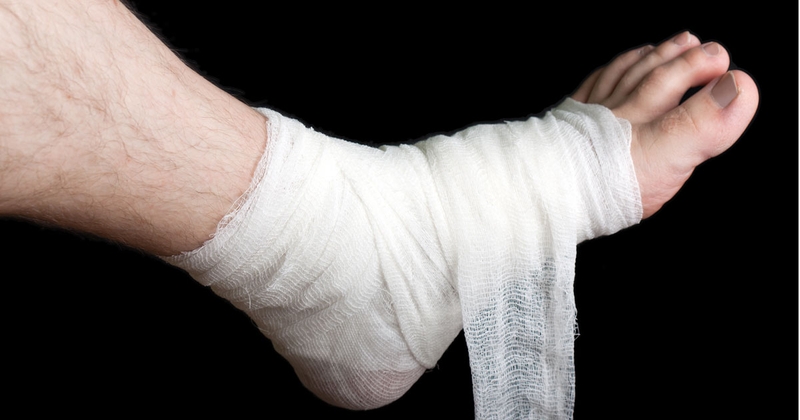 Bệnh nhân gãy xương bàn chân bao lâu thì đi lại được 1