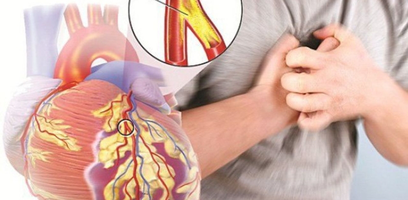 Bệnh nhân mắc bệnh suy tim sống được bao lâu? - 1