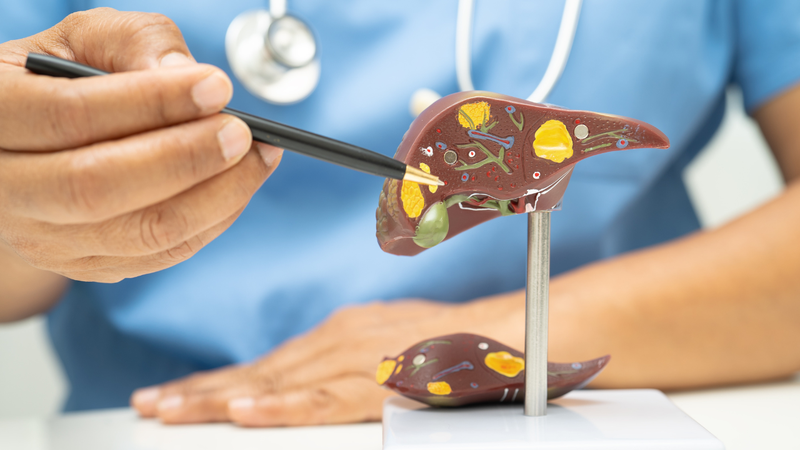 Bệnh nhân men gan cao ăn thịt gà được không?