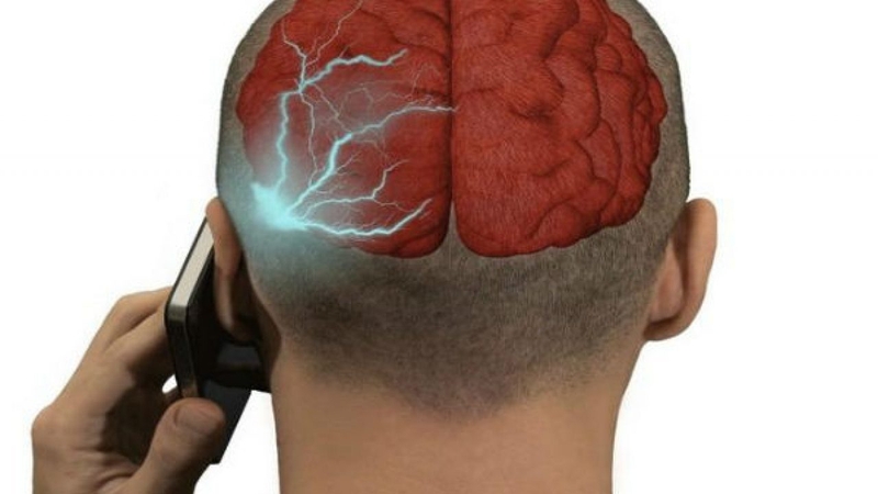 Bệnh nhân u não ác tính sống được bao lâu?