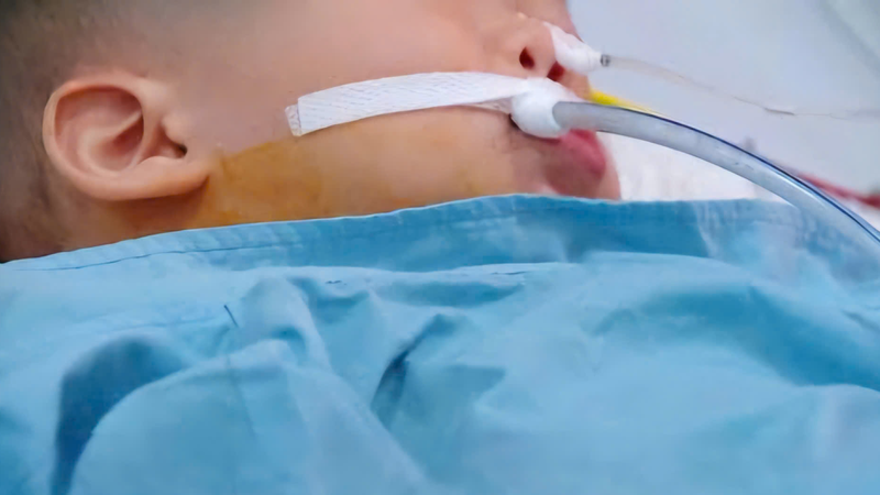 Bệnh nhi 19 tháng tuổi hiện vẫn đang được theo dõi tích cực và thở máy