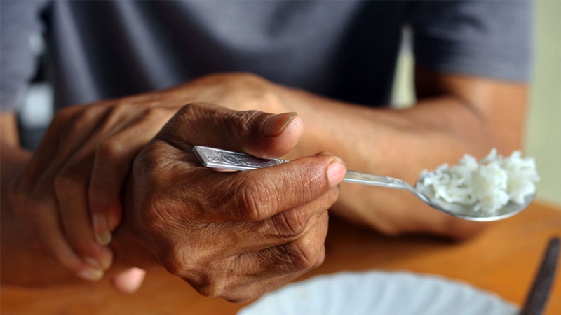 Bệnh Parkinson: Chưa có cách chữa trị nhưng các phương pháp điều trị đã được cải tiến hơn rất nhiều 1