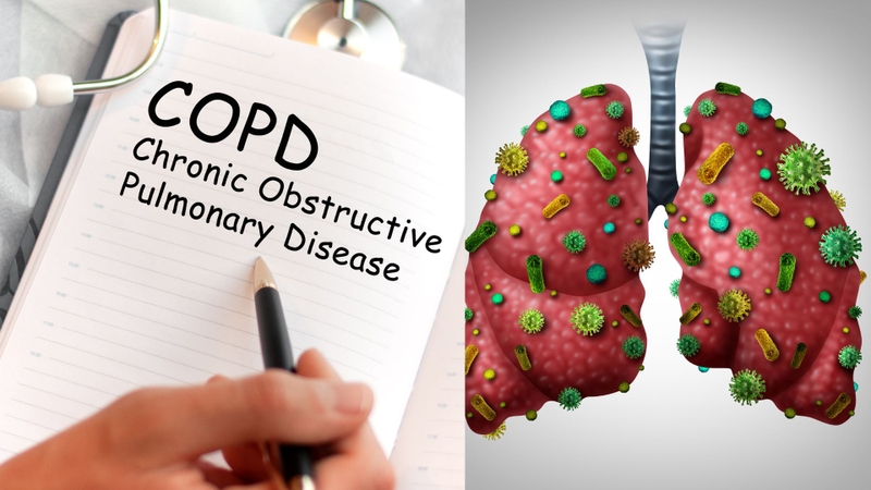 Bệnh phổi tắc nghẽn mãn tính và viêm phổi: Cách phân biệt và phòng ngừa 3