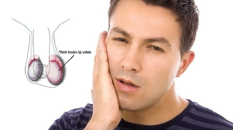 Bệnh quai bị có nguy hiểm không? 2