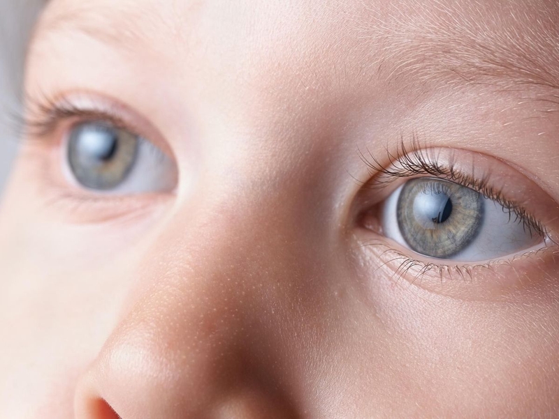 Bệnh rung giật nhãn cầu bẩm sinh là gì?3