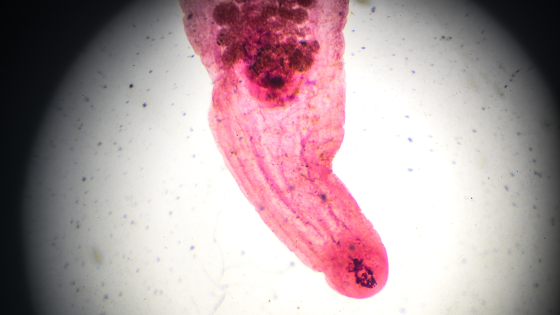 Bác sĩ sẽ chỉ định các xét nghiệm cần thiết để chẩn đoán bệnh sán lá gan