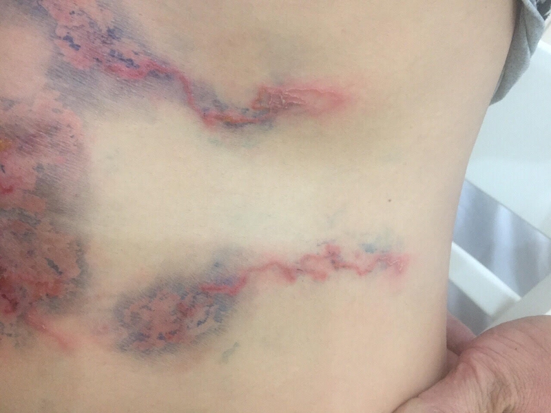 Bệnh sán lá gan ở người có nguy hiểm không?-3