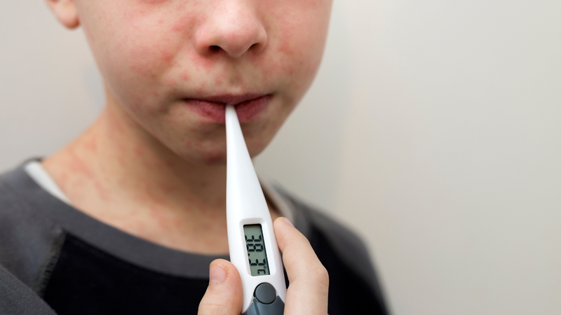 Trẻ chưa tiêm vắc xin sởi có nguy cơ mắc bệnh rất cao