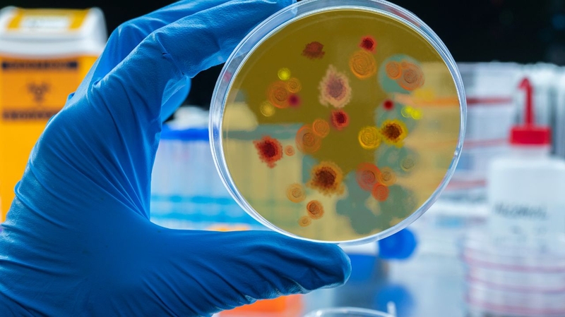 Bệnh sốt xuất huyết có bị tái lại hay không? 2