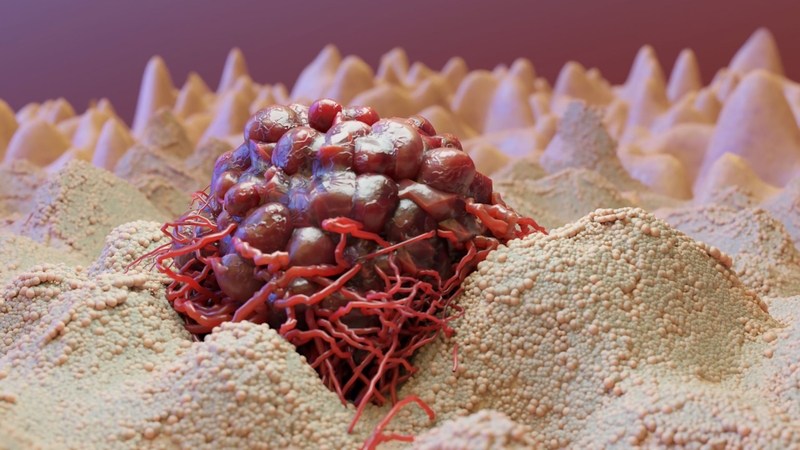 Bệnh sùi mào gà có nguy hiểm không? Các cách điều trị hiệu quả 2