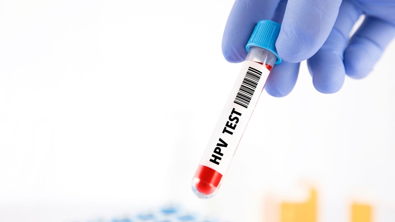 Bệnh sùi mào gà ở miệng như thế nào? Sùi mào gà ở miệng có lây không? 4