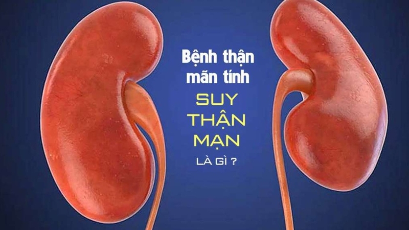 Bệnh suy thận mạn tính có chữa được không? Nguyên nhân và cách điều trị 1
