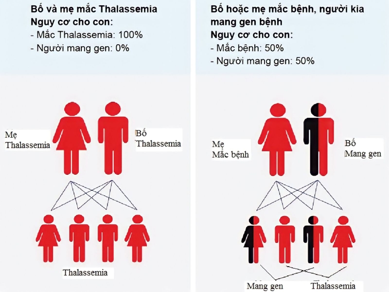 Bệnh tan máu bẩm sinh là gì? Nguyên nhân gây bệnh tan máu bẩm sinh là gì? 1