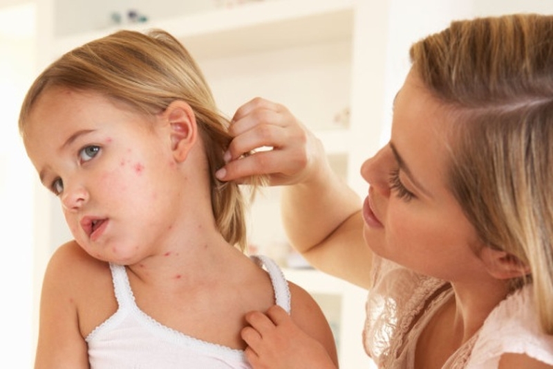 Bệnh tay chân miệng ở trẻ nhỏ: Dấu hiệu nhận biết và cách điều trị 1