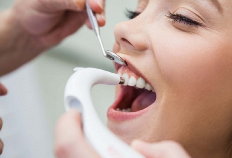 Bổ sung Fluor giúp cải thiện men răng ở bệnh nhân thiểu sản men răng mức độ nhẹ