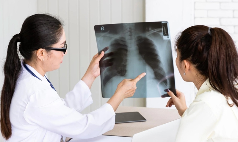 Bệnh tích protein phế nang là gì? Những vấn đề cần biết về bệnh tích protein phế nang 4