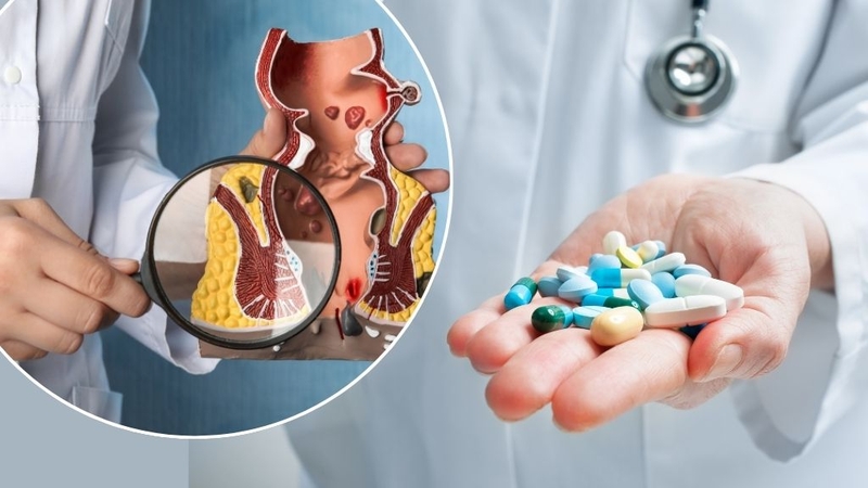 Bệnh trĩ có lây không? Giải đáp thắc mắc và những điều cần biết3