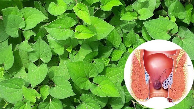 Bệnh trĩ là gì? 3 cách chữa trĩ hiệu quả tại nhà 2