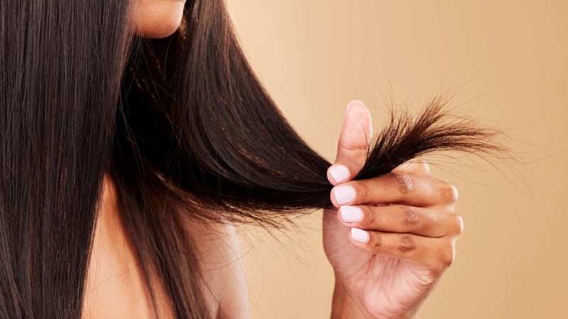 Bệnh tuyến giáp có gây rụng tóc không? 3