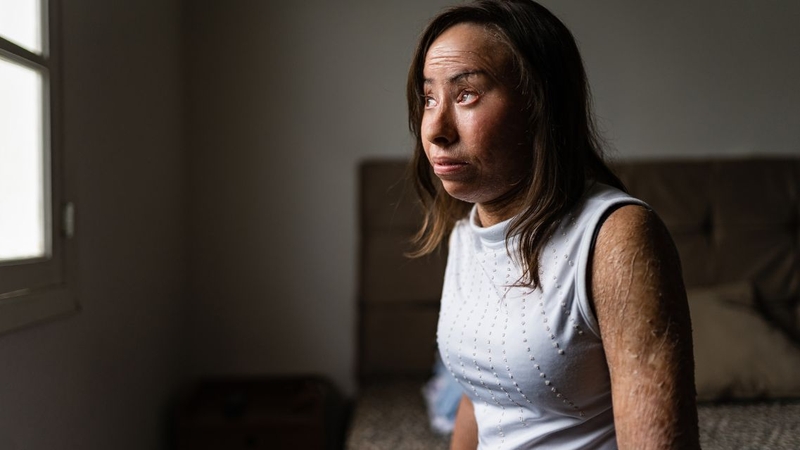 Bệnh vảy cá có lây không? Nguyên nhân và cách điều trị bệnh vảy cá 1