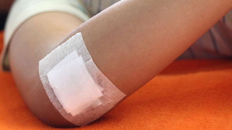 Bệnh vi khuẩn ăn thịt người cách phòng tránh hiệu quả nhất 4