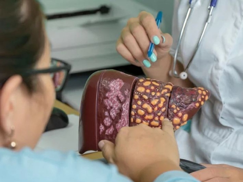 Bệnh viêm gan C có chữa được không và chữa bằng phương pháp nào? 3