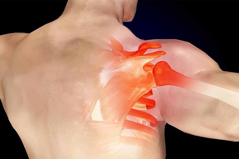 Bệnh viêm gân mạn tính: Nguyên nhân, triệu chứng và cách điều trị 2