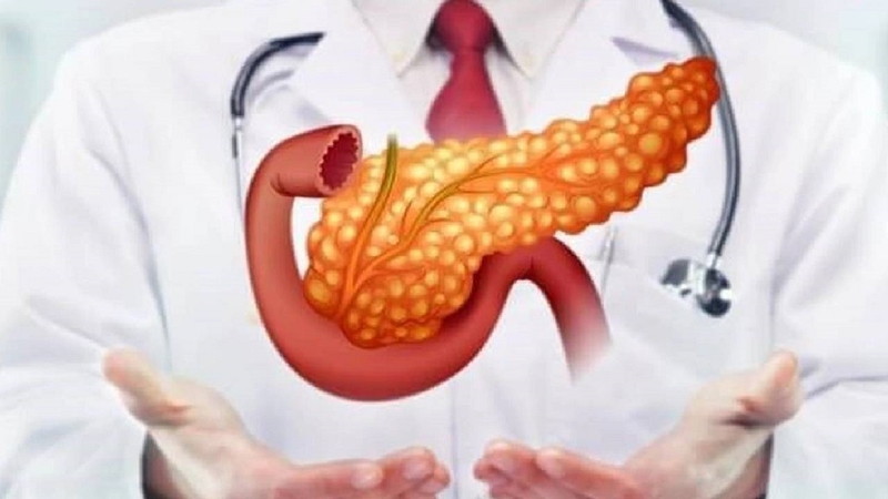 Bệnh viêm tụy cấp thể phù nề: Dấu hiệu, chẩn đoán và cách điều trị bệnh hiệu quả 4