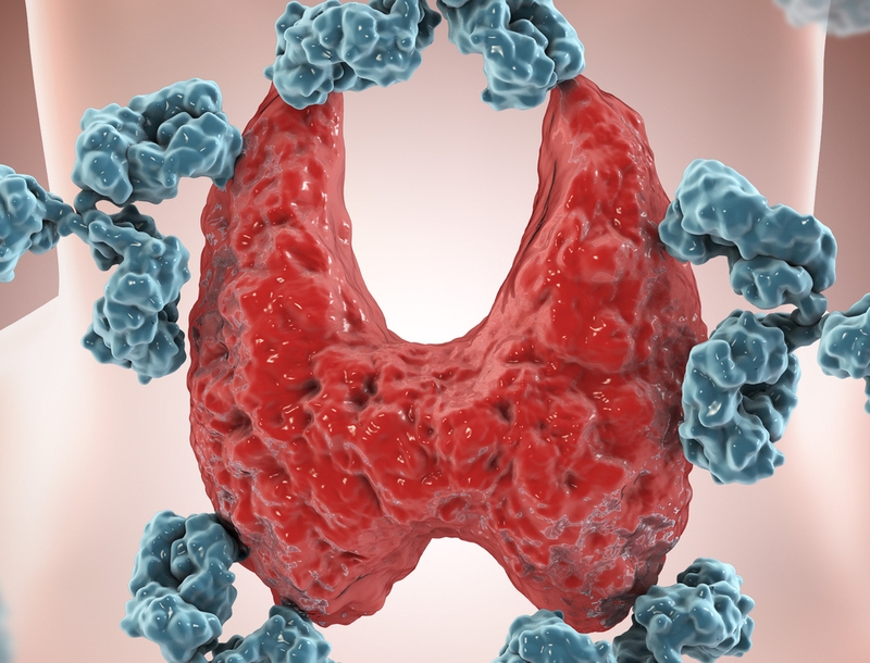 Bệnh viêm tuyến giáp hashimoto có nguy hiểm không? Nguyên nhân và phương pháp điều trị 2