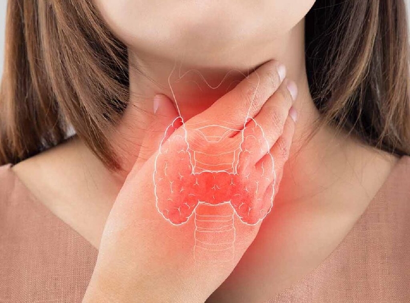 Bệnh viêm tuyến giáp hashimoto có nguy hiểm không? Nguyên nhân và phương pháp điều trị 3