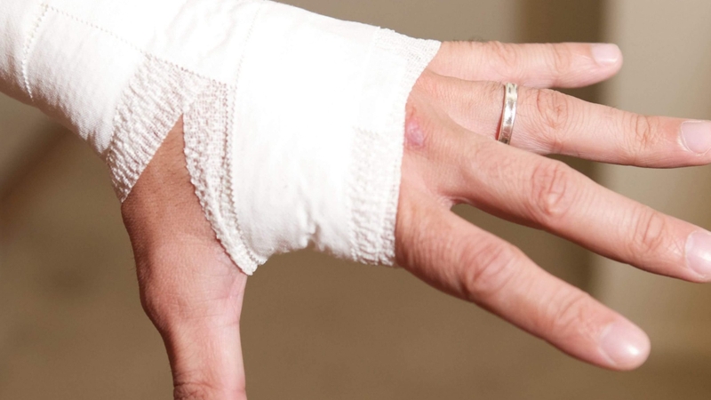 Bệnh viện chấn thương chỉnh hình 03