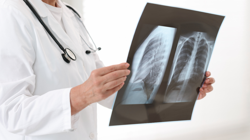 Bệnh viện Lao và bệnh Phổi tỉnh Quảng Ngãi: Cập nhật thông tin và dịch vụ 4