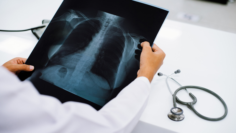 Bệnh viện Phổi Nghệ An: Thông tin cần thiết trước khi thăm khám 5