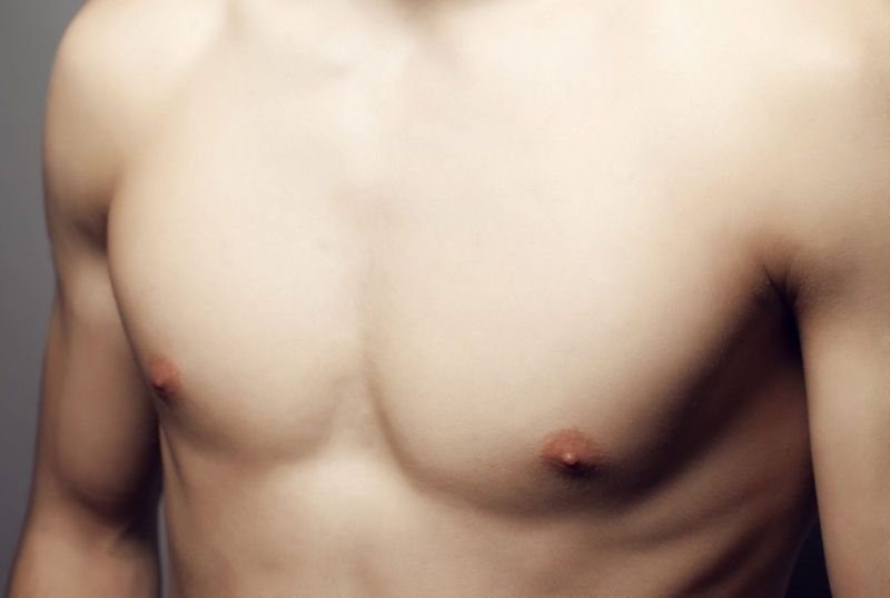 Bệnh vú to ở nam giới: Nguyên nhân và cách điều trị 1