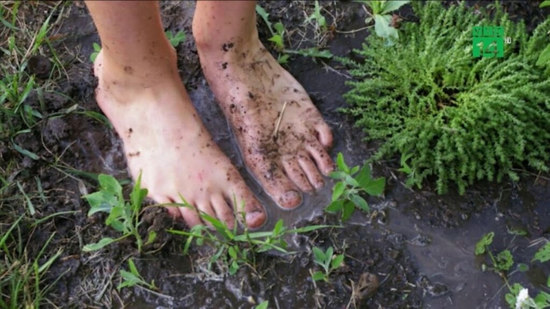 Bệnh Whitmore có chữa được không? Tìm hiểu về phương pháp điều trị hiệu quả 1