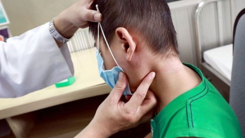 Bệnh Whitmore có chữa được không? Tìm hiểu về phương pháp điều trị hiệu quả 3