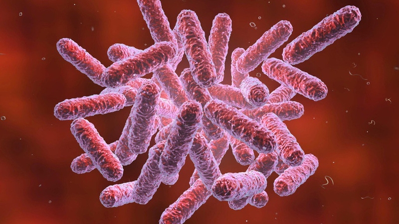 Bệnh Whitmore là gì và nó nguy hiểm như thế nào? 1