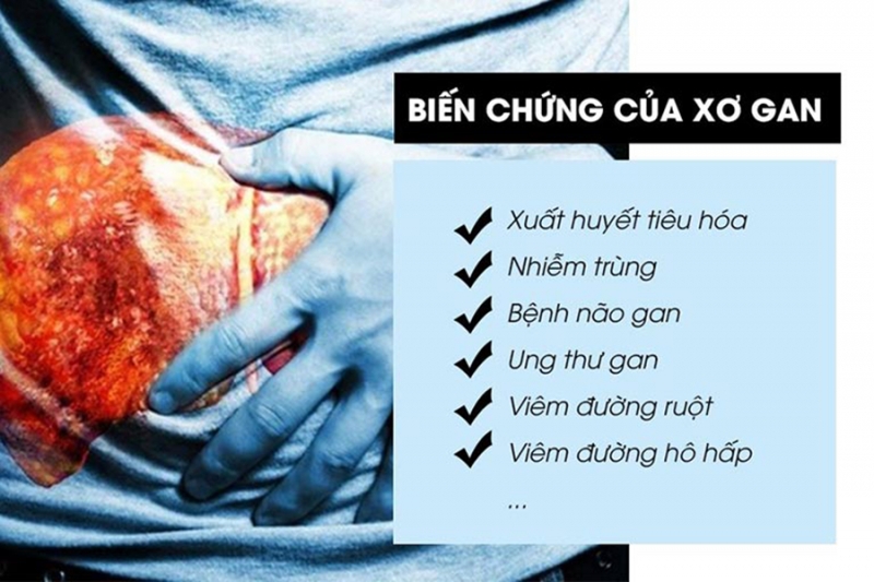 Bệnh xơ gan là gì? Xơ gan có nguy hiểm không?3