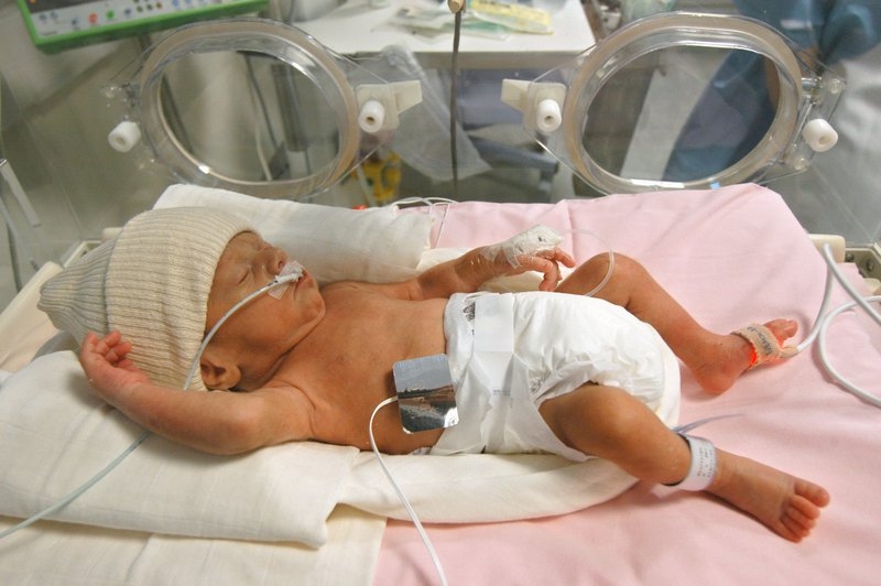 Bệnh xơ phổi ở trẻ sinh non có nguy hiểm không? Phương pháp điều trị là gì? 1