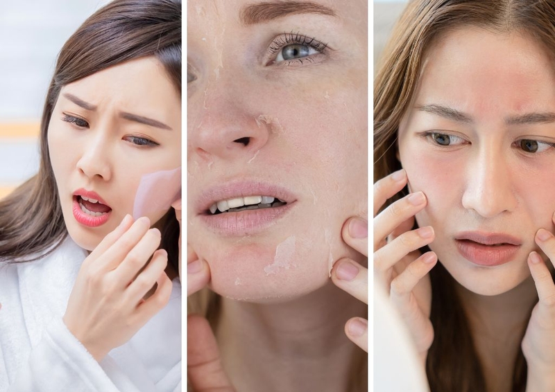 Beta Glucan trong mỹ phẩm, công dụng tuyệt vời không phải ai cũng biết 3