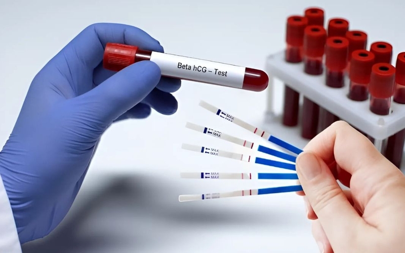 Ý nghĩa chỉ số Beta ngày 10 sau chuyển phôi 3