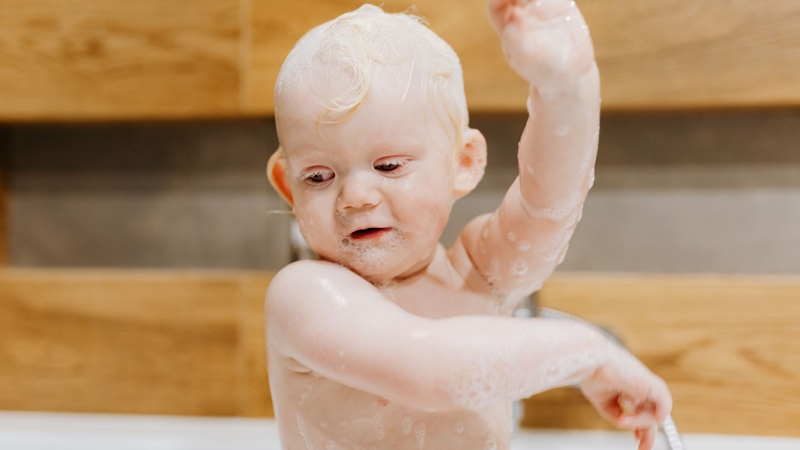 Bệnh bạch tạng có nguy hiểm không?