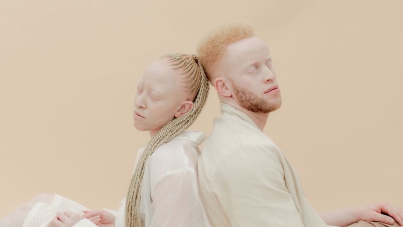 Bệnh bạch tạng không chỉ ảnh hưởng đến sức khỏe mà còn gây ra sự kỳ thị và khó khăn trong việc hòa nhập xã hội