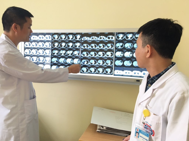 Bị bệnh u não lành tính sống được bao lâu 3